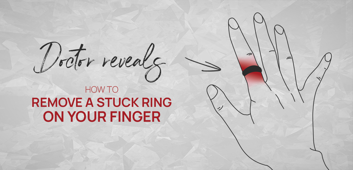 How to Remove Stuck Ring Off Finger