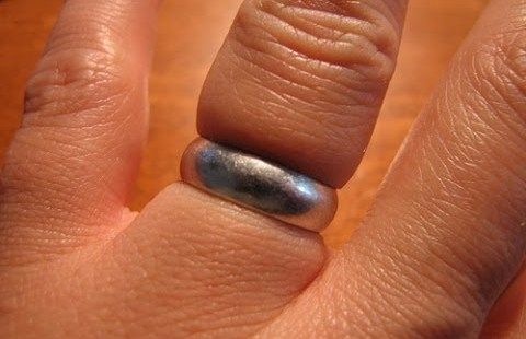 silver-ring-swollen-finger-1